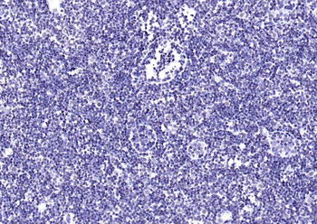 YY1 Recombinant Rabbit Monoclonal Antibody (Nuclear Loading Control)