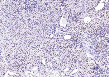 YY1 Recombinant Rabbit Monoclonal Antibody (Nuclear Loading Control)
