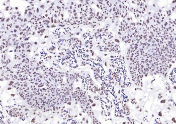 YY1 Recombinant Rabbit Monoclonal Antibody (Nuclear Loading Control)