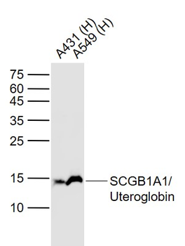 Uteroglobin Recombinant Rabbit Monoclonal Antibody