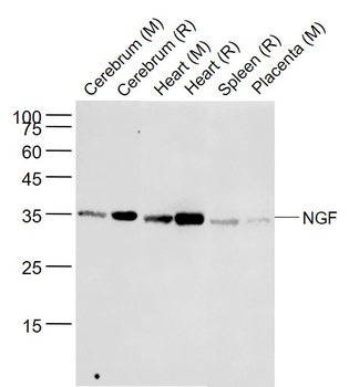 NGF Recombinant Rabbit Monoclonal Antibody