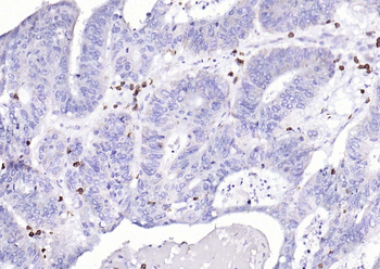 CD3 epsilon Recombinant Rabbit Monoclonal Antibody