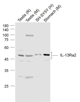 IL13RA2 Rabbit Polyclonal Antibody