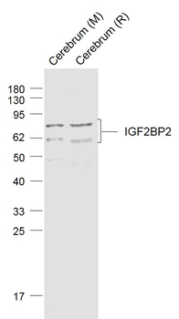 IGF2BP2 Rabbit Polyclonal Antibody