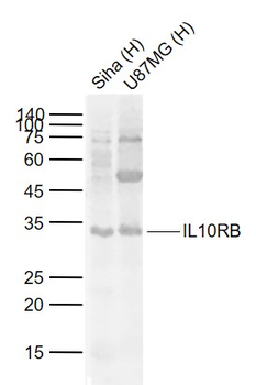 IL10RB Rabbit Polyclonal Antibody