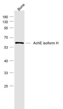 AchE isoform H Rabbit Polyclonal Antibody