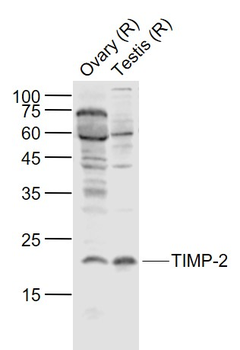 TIMP-2 Rabbit Polyclonal Antibody