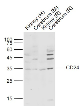 CD24 Rabbit Polyclonal Antibody