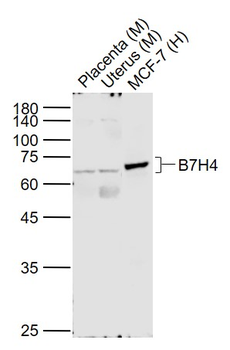 B7H4 Rabbit Polyclonal Antibody