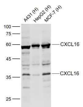 CXCL16 Rabbit Polyclonal Antibody