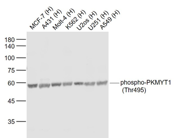 Phospho-PKMYT1 (Thr495) Rabbit Polyclonal Antibody