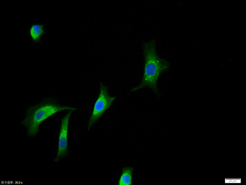 HER2 Rabbit Polyclonal Antibody