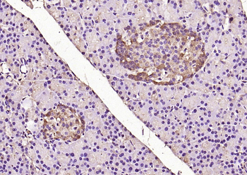 ERK2 Rabbit Polyclonal Antibody