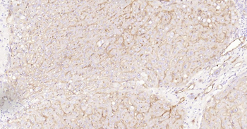 CD73 Recombinant Rabbit Monoclonal Antibody