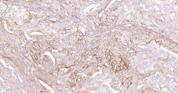 CD73 Recombinant Rabbit Monoclonal Antibody