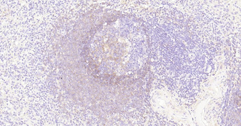 CD73 Recombinant Rabbit Monoclonal Antibody