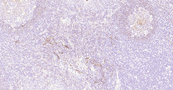 CD73 Recombinant Rabbit Monoclonal Antibody