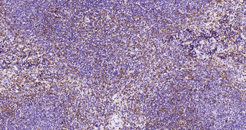 AIF1 Recombinant Rabbit Monoclonal Antibody
