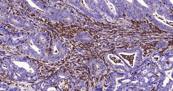 AIF1 Recombinant Rabbit Monoclonal Antibody