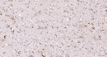 AIF1 Recombinant Rabbit Monoclonal Antibody