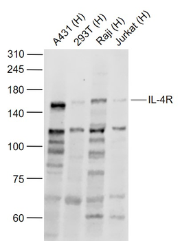 IL-4R Rabbit Polyclonal Antibody