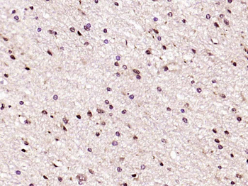 PEG3 Rabbit Polyclonal Antibody