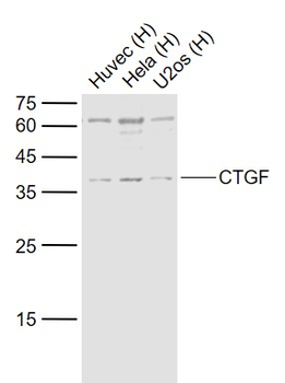 CTGF Rabbit Polyclonal Antibody