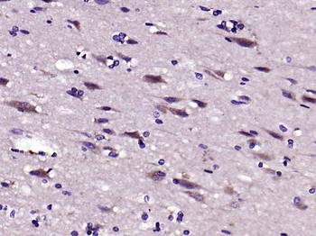 LRP1 Rabbit Polyclonal Antibody