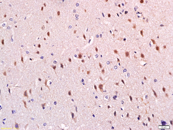 SPTBN2 Rabbit Polyclonal Antibody