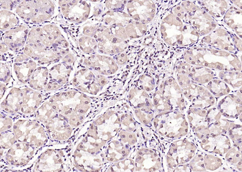 Phospho-Dnmt3a (Ser390 + Ser393) Rabbit Polyclonal Antibody