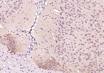 Factor B Rabbit Polyclonal Antibody