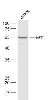 NET1 Rabbit Polyclonal Antibody