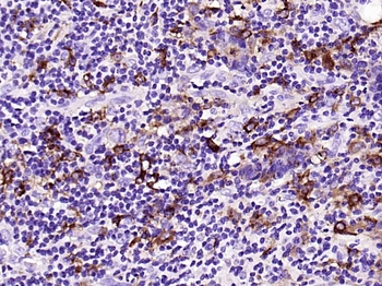 MMP9 Recombinant Rabbit Monoclonal Antibody