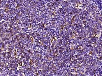 MMP9 Recombinant Rabbit Monoclonal Antibody