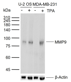 MMP9 Recombinant Rabbit Monoclonal Antibody