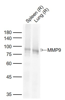 MMP9 Recombinant Rabbit Monoclonal Antibody