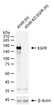 EGFR Rabbit Polyclonal Antibody