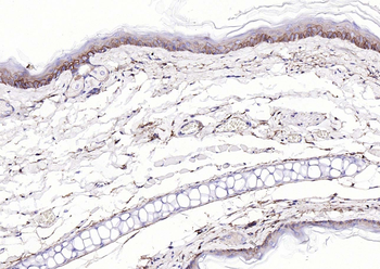 EGFR Rabbit Polyclonal Antibody