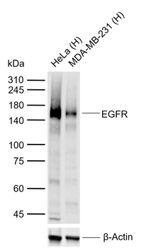 EGFR Rabbit Polyclonal Antibody