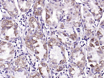 PAR-2 Rabbit Polyclonal Antibody