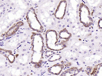 PAR-2 Rabbit Polyclonal Antibody