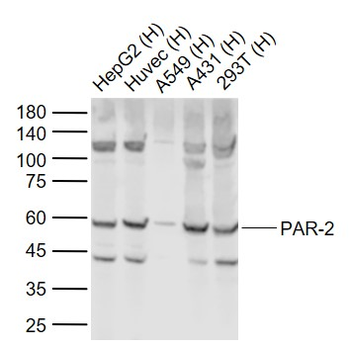 PAR-2 Rabbit Polyclonal Antibody