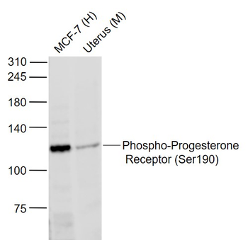 Phospho-Progesterone Receptor (Ser190) Rabbit Polyclonal Antibody