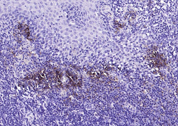 CD38 Recombinant Rabbit Monoclonal Antibody