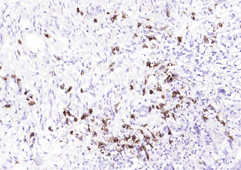 CD38 Recombinant Rabbit Monoclonal Antibody