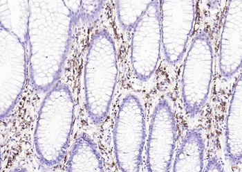 CD38 Recombinant Rabbit Monoclonal Antibody