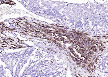 CD38 Recombinant Rabbit Monoclonal Antibody