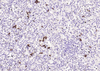 CD38 Recombinant Rabbit Monoclonal Antibody