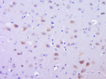 Phospho-SMAD2 (Ser464) Rabbit Polyclonal Antibody