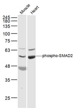 Phospho-SMAD2 (Ser464) Rabbit Polyclonal Antibody